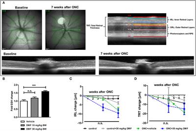 <mark class="highlighted">Neuroprotective Properties</mark> of Dimethyl Fumarate Measured by Optical Coherence Tomography in Non-inflammatory Animal Models